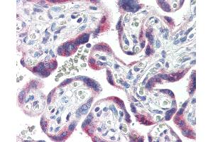 Immunohistochemistry (IHC) image for anti-Cytochrome P450, Family 26, Subfamily A, Polypeptide 1 (CYP26A1) (C-Term) antibody (ABIN364310)