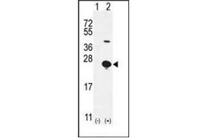 Western blot analysis of EPGN (arrow) using Epigen Antibody (N-term) Cat.