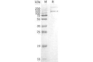 Western Blotting (WB) image for Transient Receptor Potential Cation Channel, Subfamily V, Member 1 (TRPV1) protein (ABIN7491753)