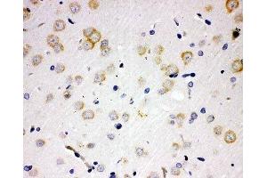 IHC-P: PAK6 antibody testing of rat brain tissue (PAK6 抗体  (N-Term))