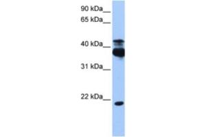 Western Blotting (WB) image for anti-serine/threonine Kinase 38 (STK38) antibody (ABIN2463209)