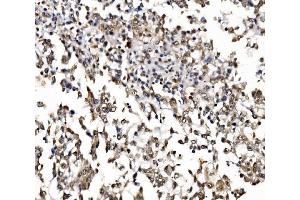 IHC analysis of NOLA1/GAR1 using anti-NOLA1/GAR1 antibody (ABIN7602076).