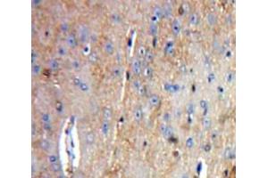 Used in DAB staining on fromalin fixed paraffin-embedded Brain tissue (Tachykinin 3 抗体  (AA 29-101))