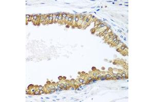 Immunohistochemistry of paraffin-embedded human prostate using LLGL2 antibody. (LLGL2 抗体)