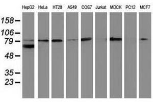 Image no. 2 for anti-Catenin (Cadherin-Associated Protein), beta 1, 88kDa (CTNNB1) antibody (ABIN1496896) (CTNNB1 抗体)