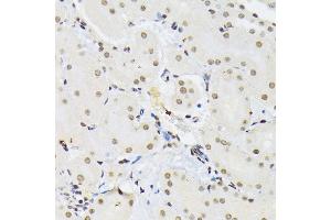 Immunohistochemistry of paraffin-embedded mouse kidney using PTBP1 antibody  at dilution of 1:100 (40x lens). (PTBP1 抗体  (AA 1-290))