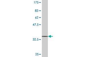 Western Blot detection against Immunogen (36. (DNAJB6 抗体  (AA 72-172))