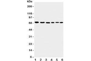 Western blot testing of Apoptosis-Inducing Factor antibody and Lane 1:  rat heart;  2: (r) brain;  3: human K562;  4: (h) HEPG2;  5: (h) A431;  6: mouse NIH3T3 cell lysate. (AIF 抗体  (C-Term))