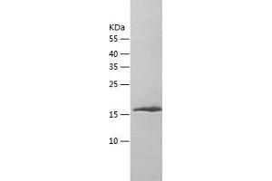 Western Blotting (WB) image for Protein Inhibitor of Activated STAT, 2 (PIAS2) (AA 1-188) protein (His tag) (ABIN7124649) (PIAS2 Protein (AA 1-188) (His tag))