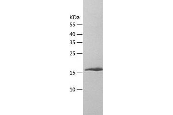 PIAS2 Protein (AA 1-188) (His tag)