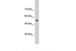 Image no. 2 for anti-Solute Carrier Family 13 Member 3 (SLC13A3) (AA 256-305) antibody (ABIN203375)