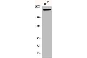 Western Blot analysis of HeLa cells using DNA-PKCS Polyclonal Antibody (PRKDC 抗体  (C-Term))