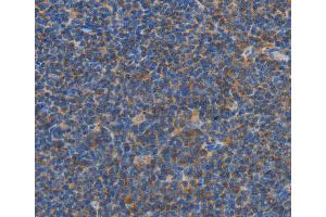 Immunohistochemistry (IHC) image for anti-Caspase Recruitment Domain Family, Member 6 (CARD6) antibody (ABIN2432767) (CARD6 抗体)