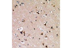 Immunohistochemical analysis of p53 (pS376) staining in human brain formalin fixed paraffin embedded tissue section. (p53 抗体  (C-Term, pSer376))