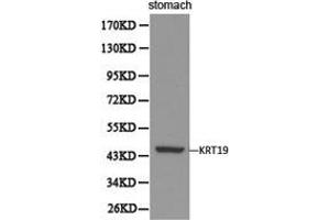 Western Blotting (WB) image for anti-Keratin 19 (KRT19) antibody (ABIN1873481) (Cytokeratin 19 抗体)