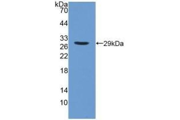 PNPLA2 抗体  (AA 484-701)
