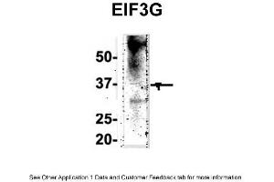 IP Suggested Anti-EIF3G Antibody Positive Control: NT2 CELL/BRAIN TISSUE (EIF3G 抗体  (Middle Region))