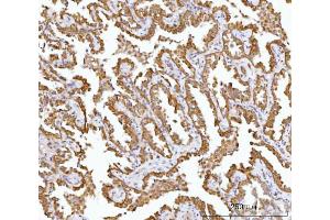 IHC analysis of AGPS using anti-AGPS antibody (ABIN7600146).
