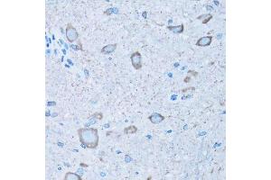 Immunohistochemistry of paraffin-embedded mouse spinal cord using NNMT antibody. (NNMT 抗体  (AA 1-264))