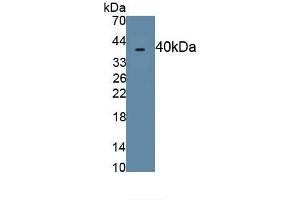 Detection of Recombinant MIP4a, Human using Polyclonal Antibody to Macrophage Inflammatory Protein 4 Alpha (MIP4a) (CCL26 抗体  (AA 24-94))