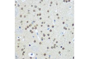 Immunohistochemistry of paraffin-embedded Mouse brain using UB antibody (2359) at dilution of 1:100 (40x lens). (UBA1 抗体  (AA 300-600))
