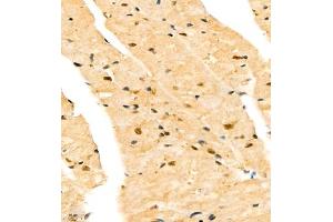 Immunohistochemistry of paraffin embedded mouse heart using CITED4 (ABIN7073356) at dilution of 1:2200 (400x lens)