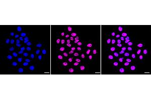 anti-HIV-1 Tat Specific Factor 1 (HTATSF1) antibody