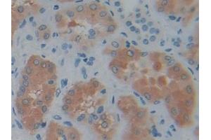 Immunohistochemistry (IHC) image for anti-phosphoserine Aminotransferase 1 (PSAT1) (AA 1-312) antibody (ABIN7435646)