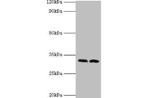 Western blot All lanes: RDM1 antibody at 4 μg/mL Lane 1: PC-3 whole cell lysate Lane 2: MCF-7 whole cell lysate Secondary Goat polyclonal to rabbit IgG at 1/10000 dilution Predicted band size: 32, 30, 16, 14, 29, 26, 9, 13, 19, 27 kDa Observed band size: 32 kDa (RDM1 抗体  (AA 125-284))
