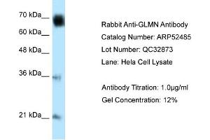 WB Suggested Anti-GLMN Antibody Titration: 0.