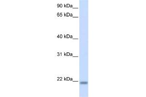 Western Blotting (WB) image for anti-CCHC-Type Zinc Finger, Nucleic Acid Binding Protein (CNBP) (N-Term) antibody (ABIN2776037)