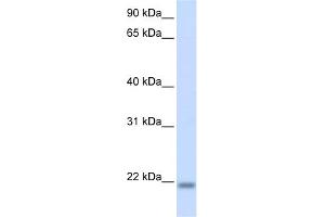 WB Suggested Anti-CNBP Antibody Titration:  0. (CNBP 抗体  (N-Term))