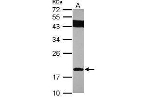 WB Image Sample (30 ug of whole cell lysate) A: IMR32 12% SDS PAGE antibody diluted at 1:1000 (SUMO2 抗体)