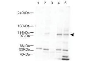 Image no. 1 for anti-SWI/SNF Related, Matrix Associated, Actin Dependent Regulator of Chromatin, Subfamily A-Like 1 (SMARCAL1) (AA 80-96) antibody (ABIN401264) (SMARCAL1 抗体  (AA 80-96))
