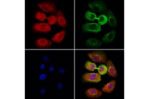 ABIN6264773 and ABIN6278630 staining Hela cells by IF/ICC. (URI1 抗体  (Internal Region))