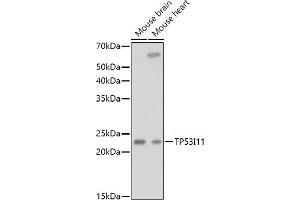Western blot analysis of extracts of various cell lines, using TP53I11 antibody (ABIN6131365, ABIN6149418, ABIN6149419 and ABIN6216636) at 1:1000 dilution. (TP53I11 抗体  (AA 1-70))