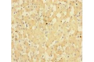 Immunohistochemistry of paraffin-embedded human liver tissue using ABIN7143148 at dilution of 1:100 (SUB1 抗体  (AA 2-127))