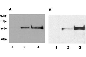 Western blot analysis of repetin expression in cytosolic (lane 1), membrane (lane 2) and cytoskeletal (lane 3) extracts from suspension-induced human keratinocytes (A) and human foreskin biopsy (B) using anti-Repetin, pAb (AF646) . (Repetin 抗体  (AA 570-584))