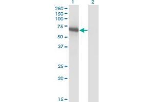 Western Blot analysis of BIN1 expression in transfected 293T cell line by BIN1 monoclonal antibody (M01), clone 1H1. (BIN1 抗体  (AA 355-454))