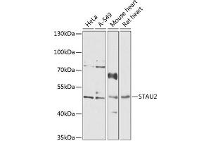 Western blot analysis of extracts of various cell lines, using ST antibody  at 1:1000 dilution. (Double-stranded RNA-binding protein Staufen homolog 2 (STAU2) (AA 300-400) 抗体)