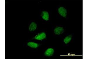Immunofluorescence of purified MaxPab antibody to HDAC9 on HeLa cell. (HDAC9 抗体  (AA 1-1069))