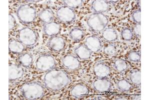 Immunoperoxidase of monoclonal antibody to HCLS1 on formalin-fixed paraffin-embedded human colon. (HCLS1 抗体  (AA 266-355))