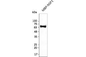 Western Blotting (WB) image for anti-SARS-CoV-2 Host Translation Inhibitor Nsp1 (NSP1) antibody (ABIN7272996) (SARS-CoV-2 NSP1 抗体)