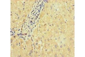 Immunohistochemistry (IHC) image for anti-Solute Carrier Family 38, Member 9 (SLC38A9) (AA 1-119) antibody (ABIN7169972)