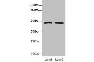 Western blot All lanes: GCM1antibody at 1. (GCM1 抗体  (AA 207-436))