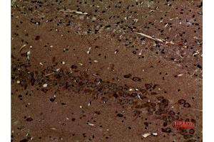 Immunohistochemistry (IHC) analysis of paraffin-embedded Rat Brain, antibody was diluted at 1:100. (Myosin VI 抗体  (N-Term))