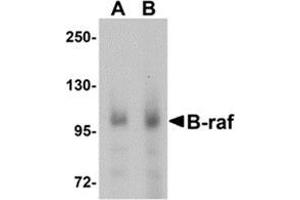 Western blot analysis of B-raf in human brain tissue lysate with B-raf antibody at (A) 1 and (B) 2 μg/ml. (BRAF 抗体  (Center))