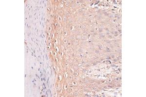 Immunohistochemistry of paraffin-embedded human skin using CDH3 antibody (ABIN7269142) at dilution of 1:100 (40x lens). (P-Cadherin 抗体  (AA 24-350))