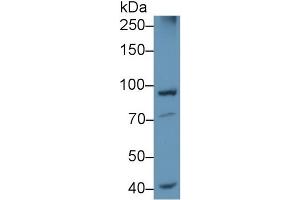 Detection of PSMD2 in Rat Cerebrum lysate using Polyclonal Antibody to Proteasome 26S Subunit, Non ATPase 2 (PSMD2)