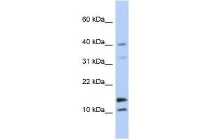 WFDC5 antibody used at 1 ug/ml to detect target protein. (WFDC5 抗体  (N-Term))